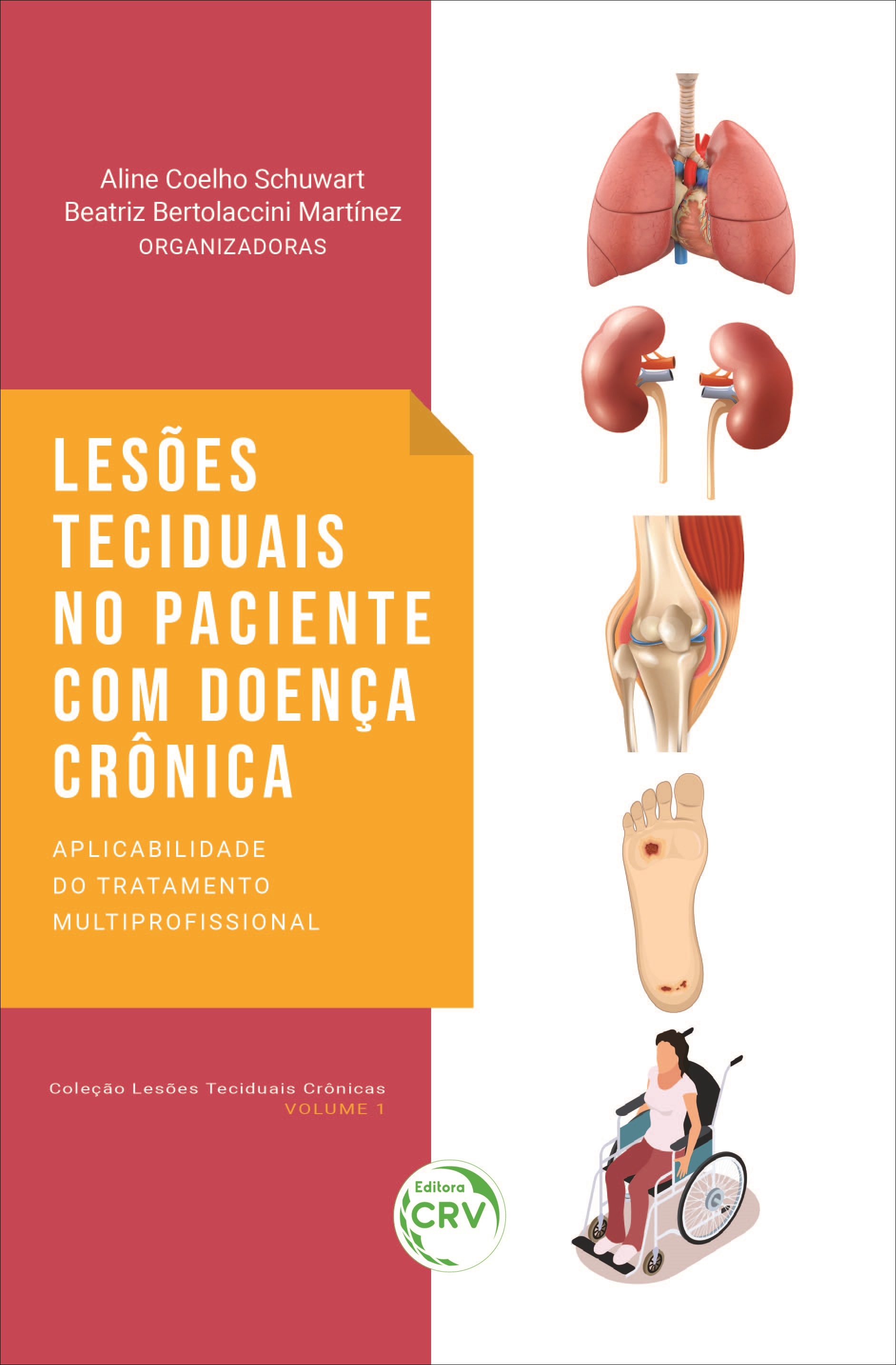 Capa do livro: LESÕES TECIDUAIS NO PACIENTE COM DOENÇA CRÔNICA:<br> aplicabilidade do tratamento multiprofissional <br>Coleção Lesões Teciduais Crônicas - Volume 1